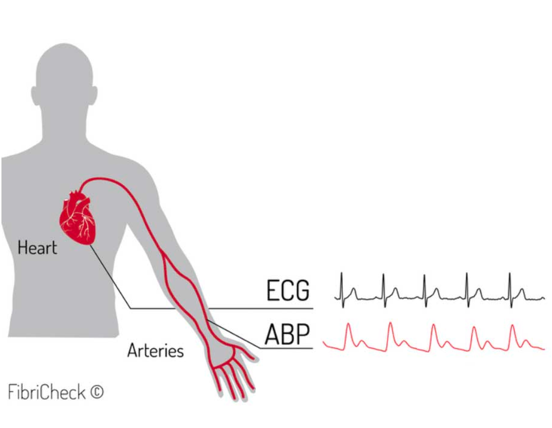 ECG ABP.png