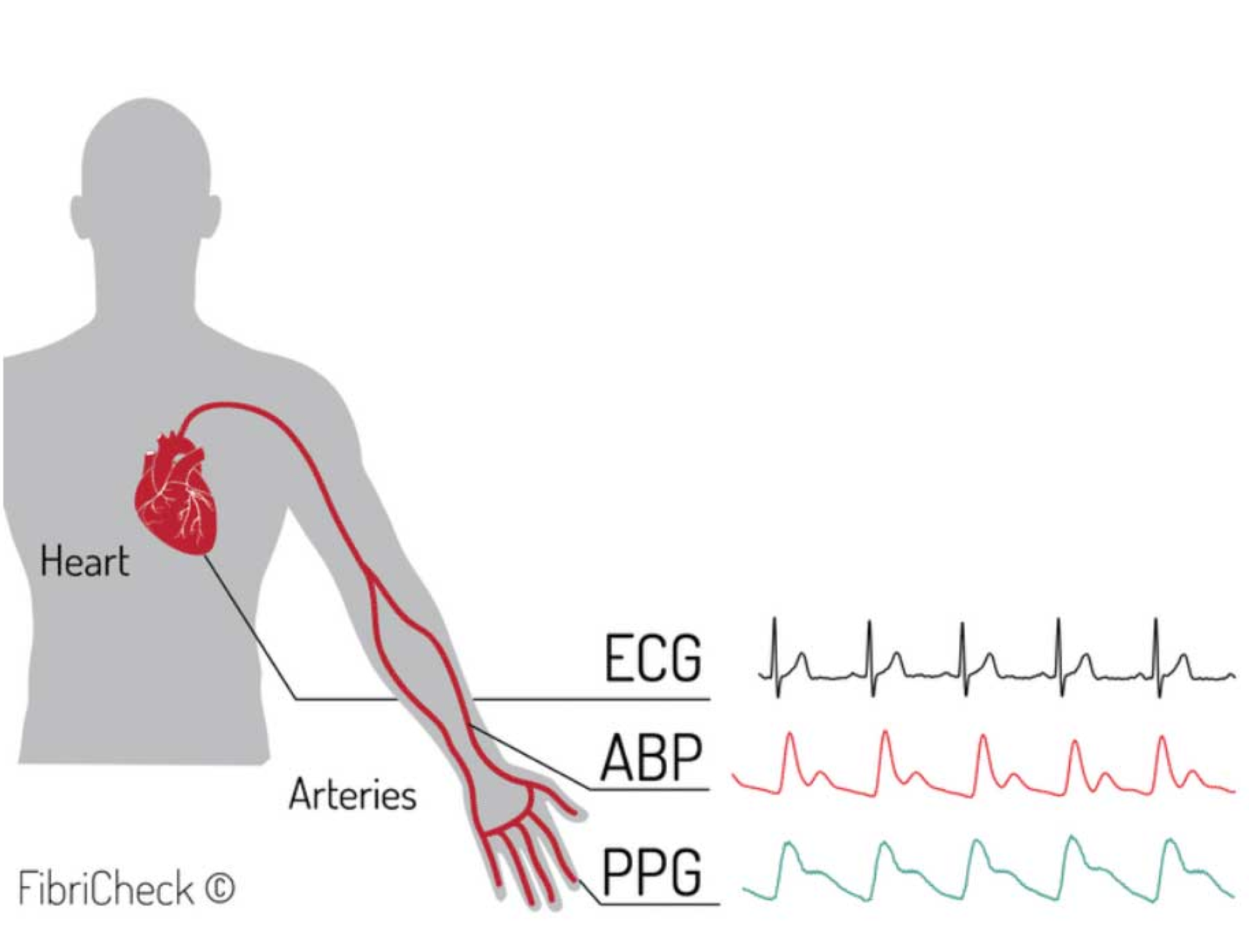 ECG ABP PPG.png