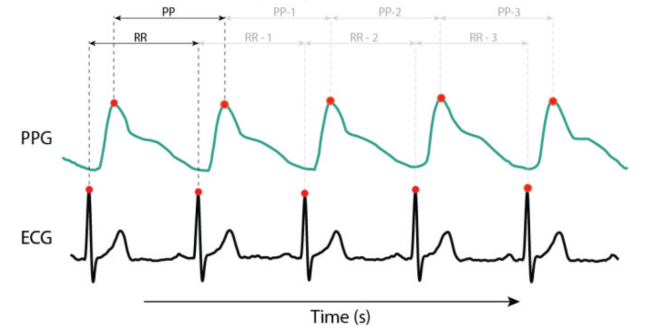PPG_vs_ECG.png